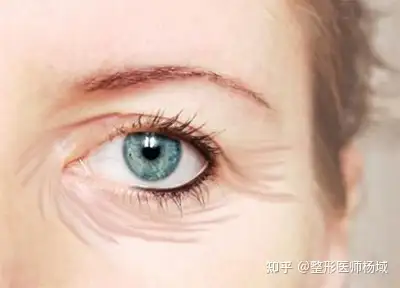 整形科普眼部整形都有哪些针对眼周老化的手段