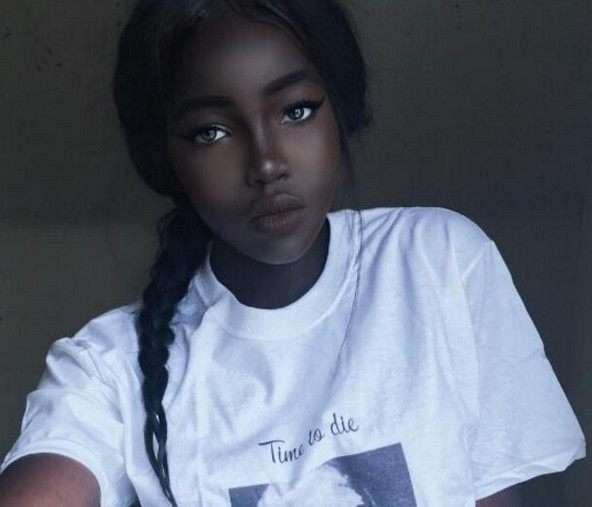 皮肤黑会造成什么样的心里?