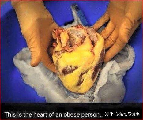 皮下脂肪和内脏脂肪怎么区别