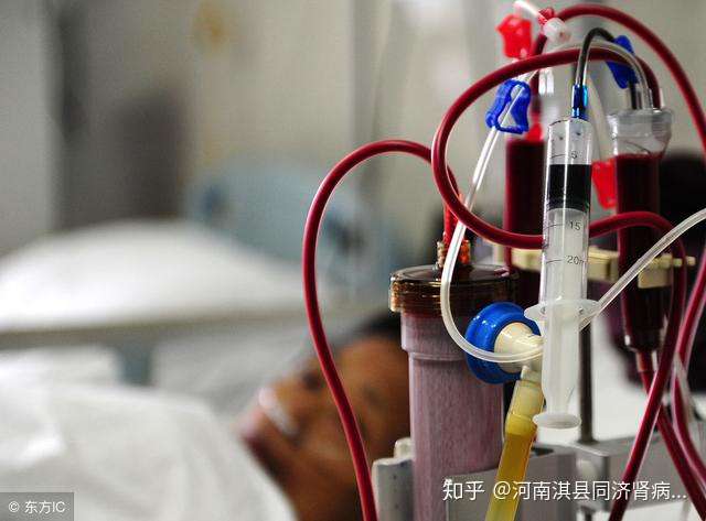 血液透析常见的问题有哪些？肾内科医生为你解答