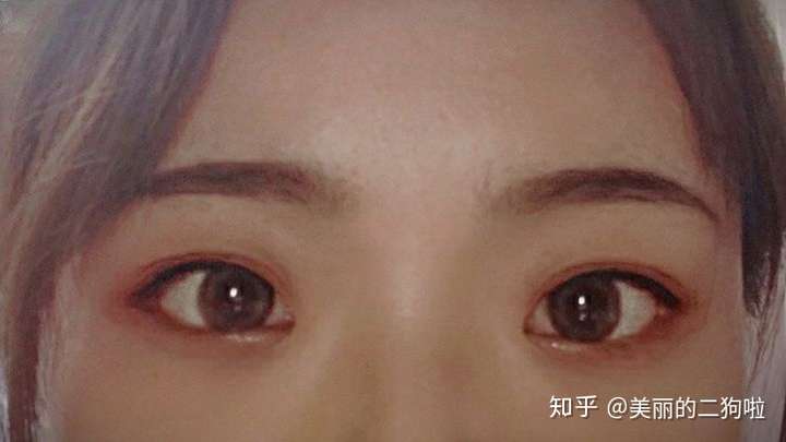 眼距宽是种什么体验?