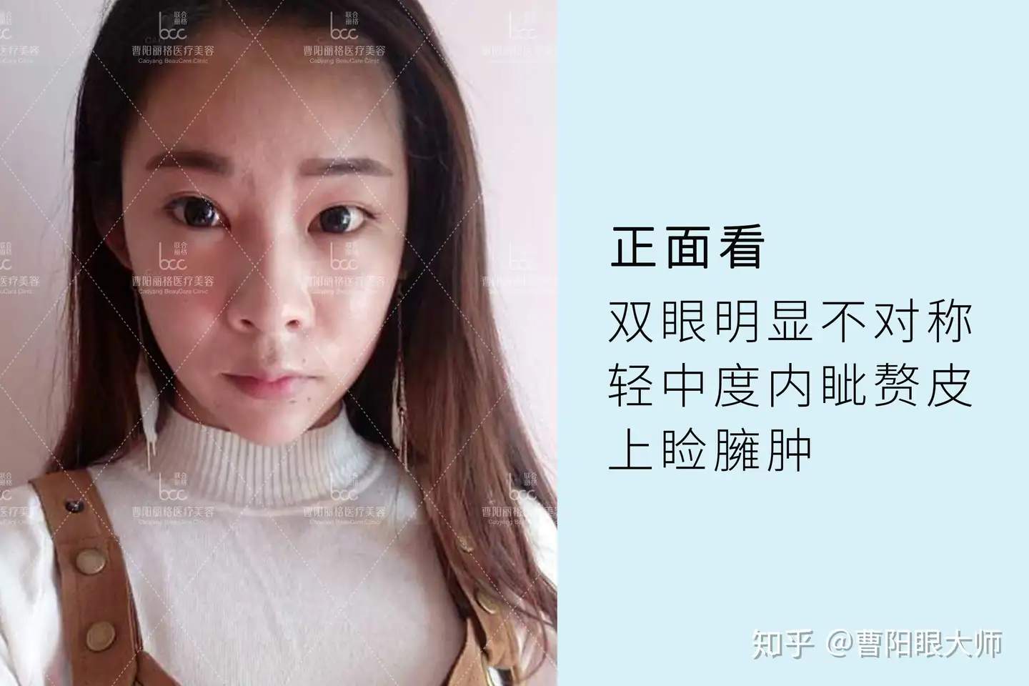 告别大小眼，处女座主播力争完美直播- 知乎