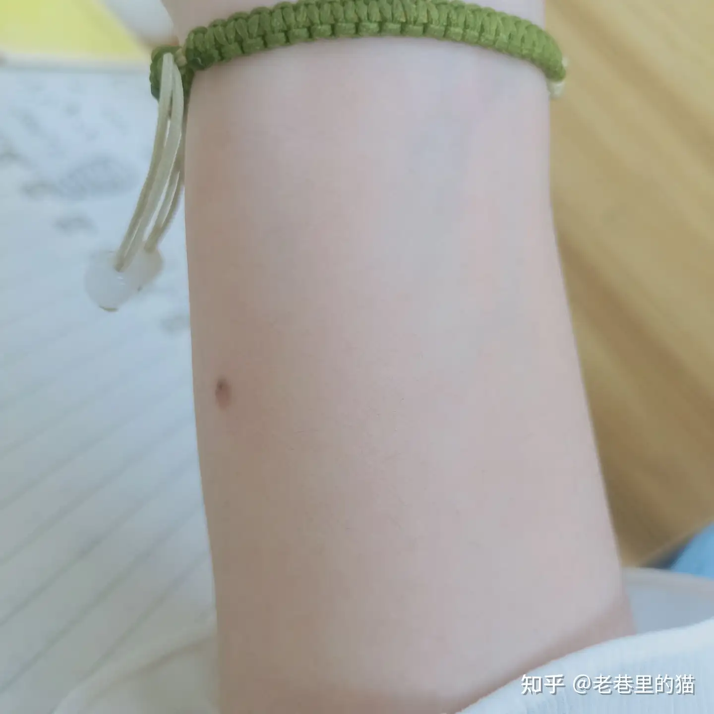 有没有人和我一样右手臂有朱砂痣的朋友? - 知乎