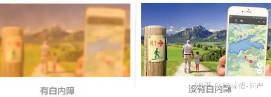 白内障是什么？