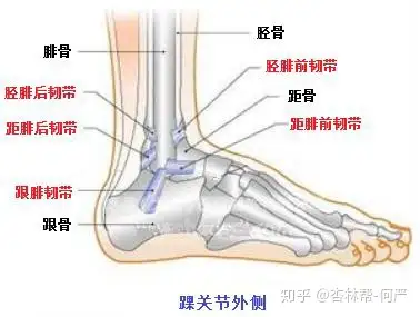踝关节扭伤别大意 小心外侧副韧带损伤 知乎