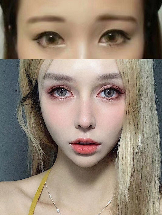 大家觉得做双眼皮是去三甲医院还是整形医院?