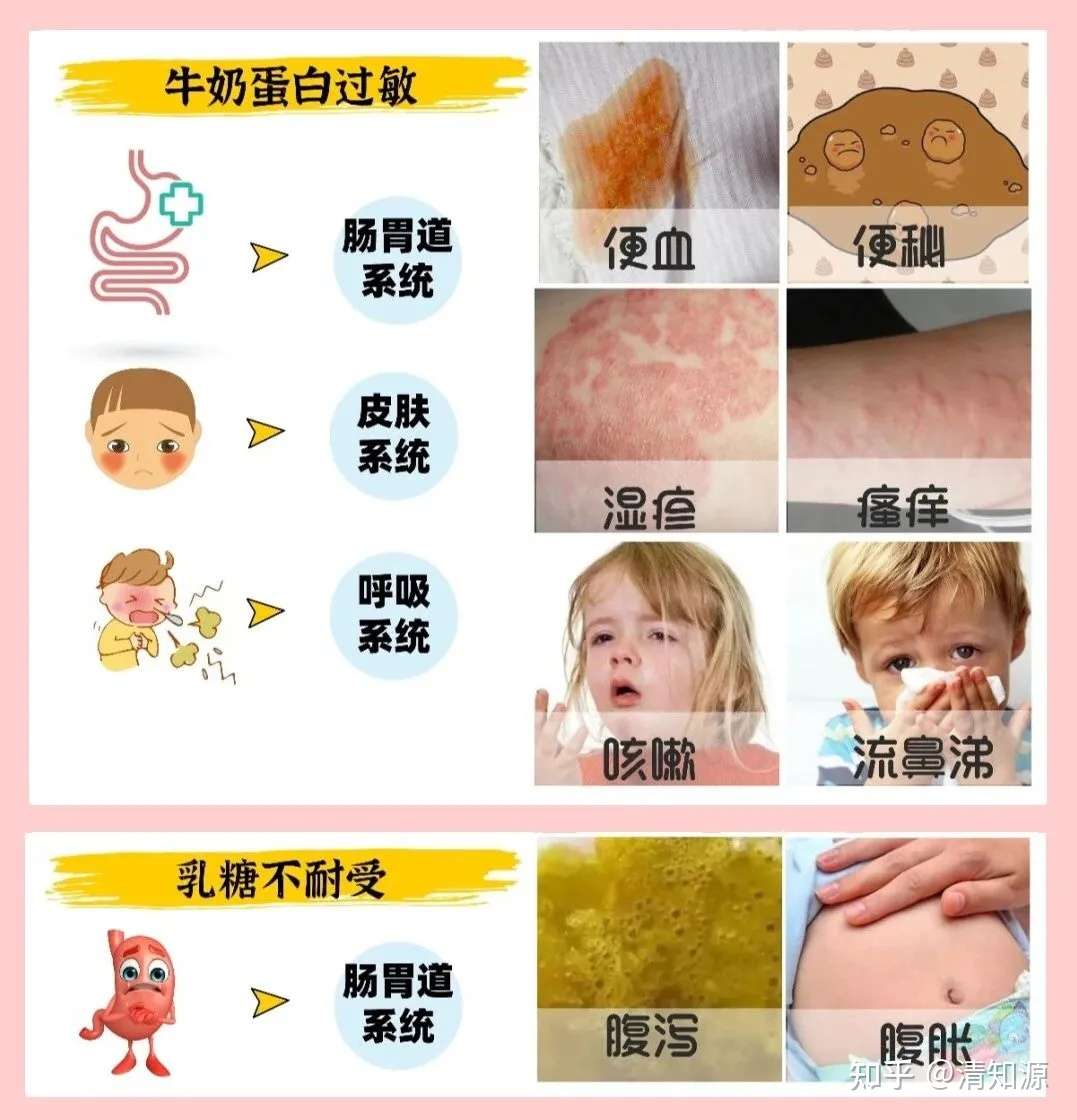 宝宝喝奶后腹胀 腹泻 呕吐 1招教你快速区分牛奶蛋白过敏和乳糖不耐受 家长一定要分清 知乎