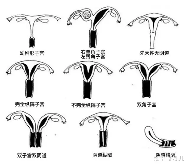 暗抱畸杖扯什么幸嫂毒败决？(图3)