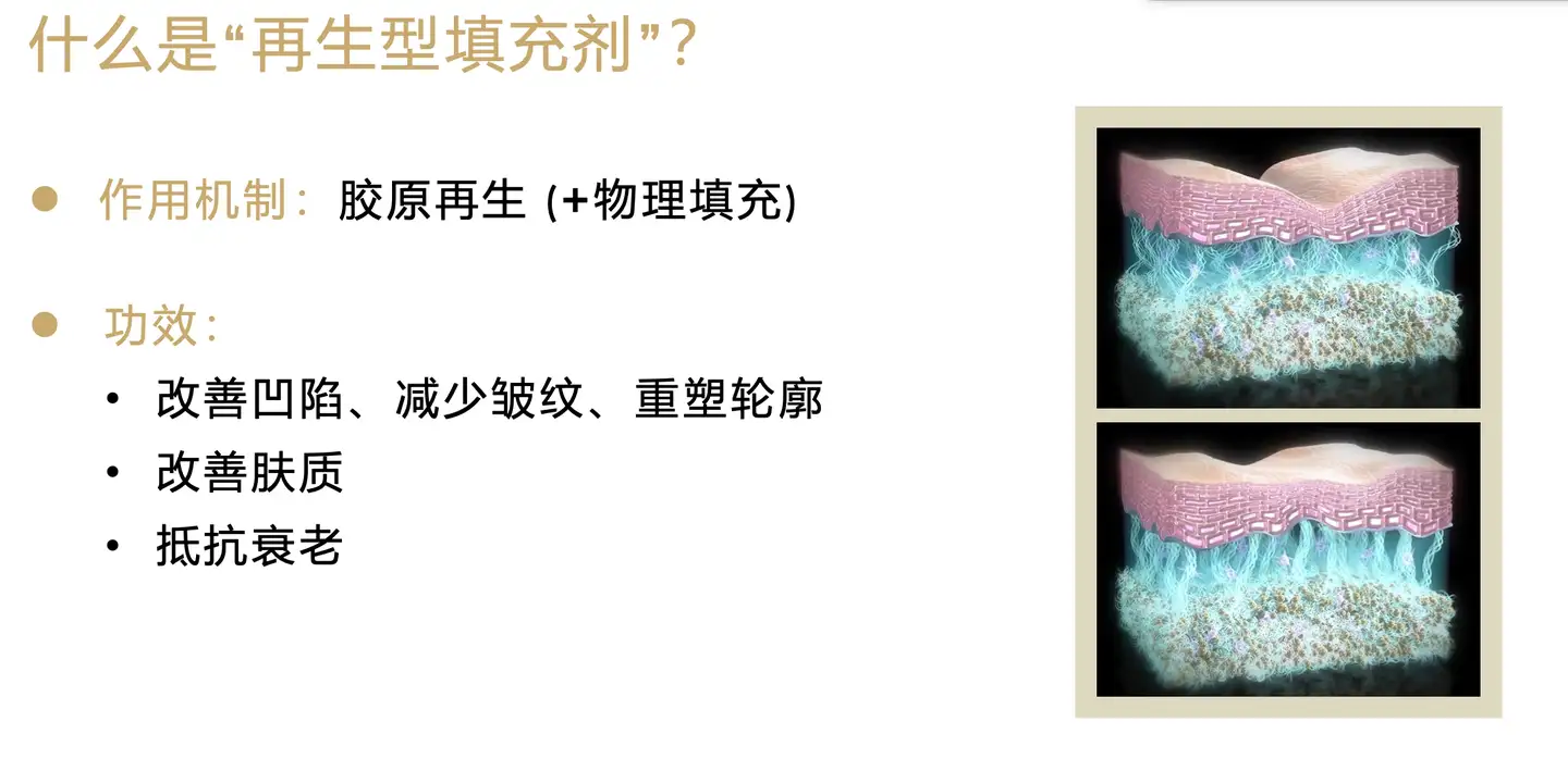 专业分析：打完4支少女针，我有发言权了- 知乎