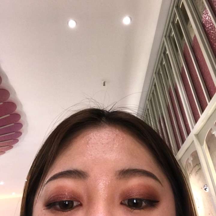 多层眼皮的专业名字叫什么啊?遗传规律是什么?