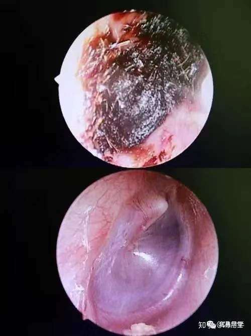 一封"耳屎"的自白书