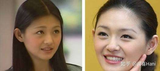美白针最早是从大s的《揭发女明星——美容大王 2》里传出,以打点滴