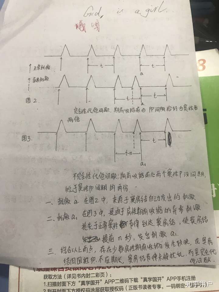 到底什么叫作完全代偿间歇?