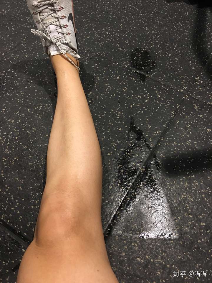 这样的腿形能练出来吗? - 知乎