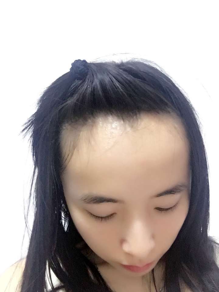 额头大是怎样的一种体验?