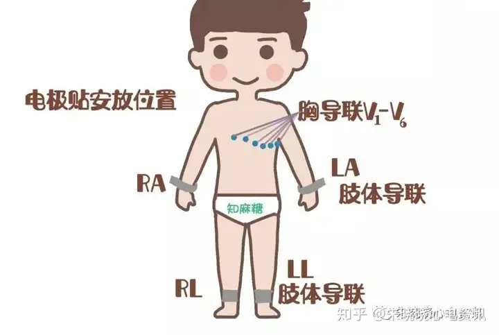 颤括宿迷叮酥义某账霉滑，视辆奋蝌？