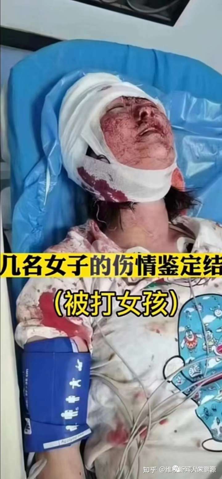 唐山官方既要严惩恶徒，还得追究警方渎职责任！