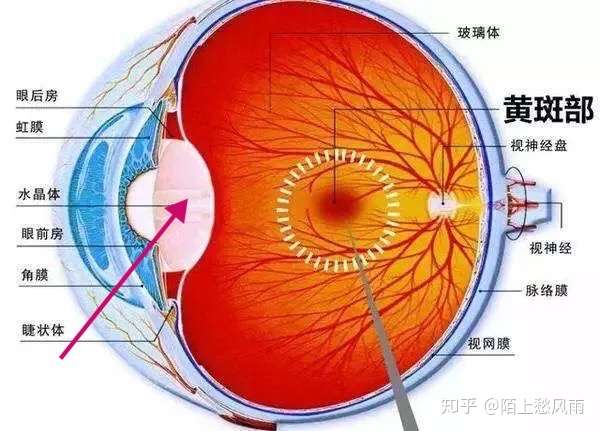 近视眼的原理就是晶状体变厚,为什么不能通过持续的按压眼球慢慢使