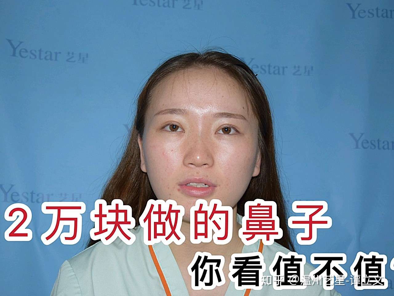 美丽分享 两万块做的鼻子 你看值不值 知乎 美丽分享 两万块做的鼻子 你看值不值 知乎