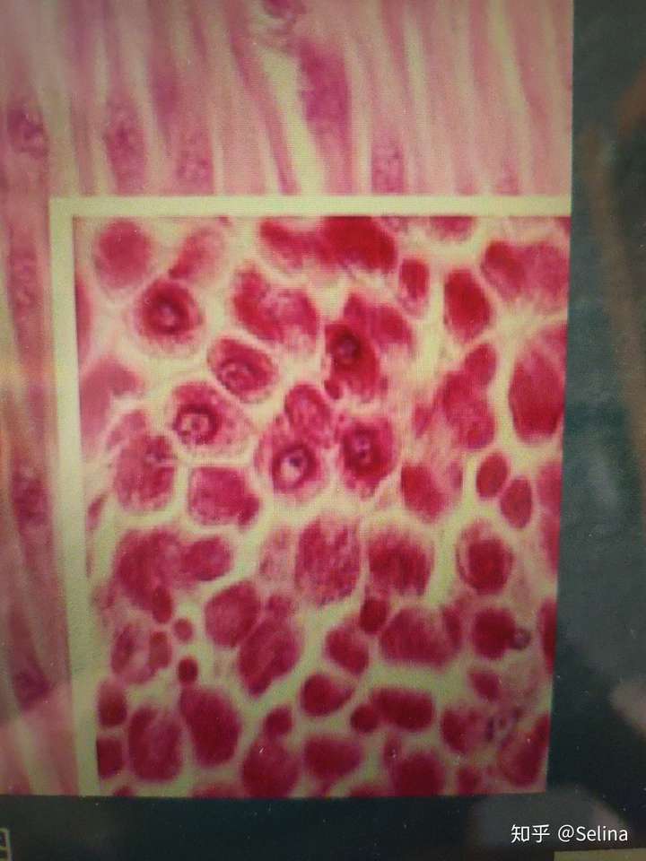 横切时平滑肌纤维与心肌纤维怎么区别