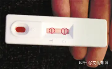 艾滋病試紙檢測有假陰性嗎?