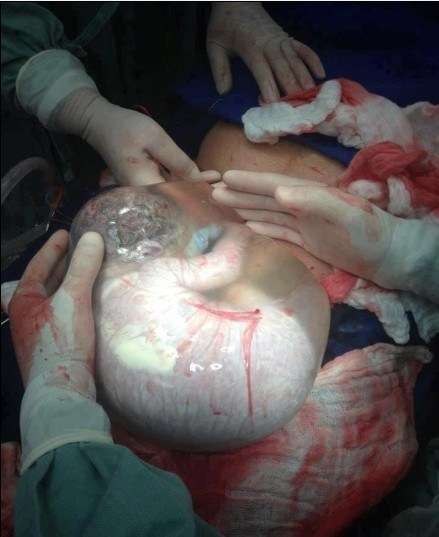 包裹哪吒的肉球到底是什么东西