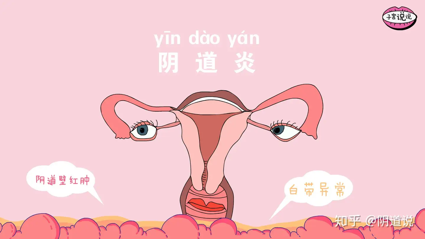 阴 道 内 部 - funphotoguys.com.