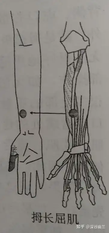 讀書筆記指屈肌觸發點