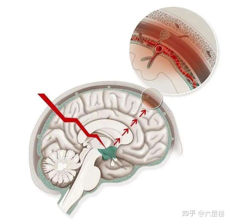 25岁高发 这种可能伴随一生的 疼痛 已折磨无数女性 知乎