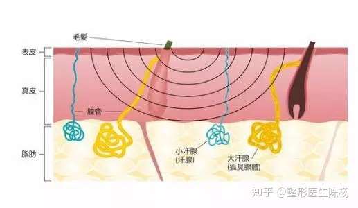 狐臭手術到底有沒有用