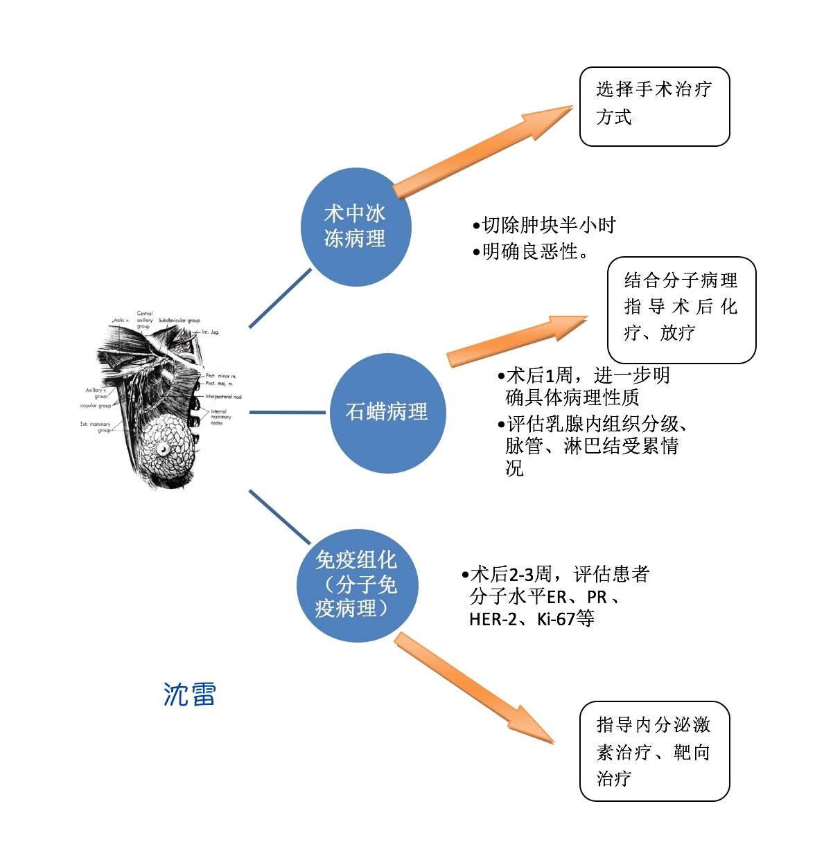 乳腺癌治疗相关事项 知乎