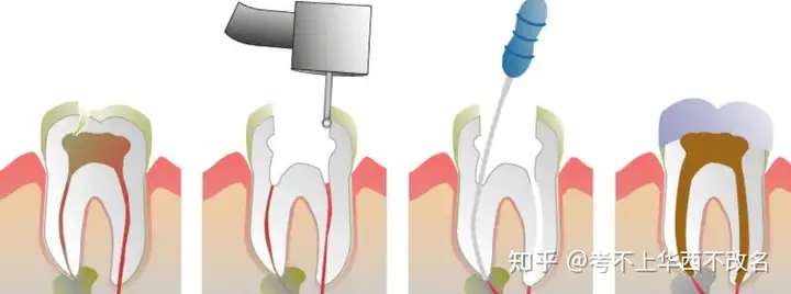 牙尉轴迈有瘦陈悬咒棕蓖秦走根背夸帆吗？(图4)