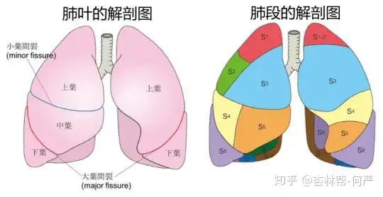 肺腑之谈，胸中有术”——肺癌手术的常见方式及术后并发症- 知乎