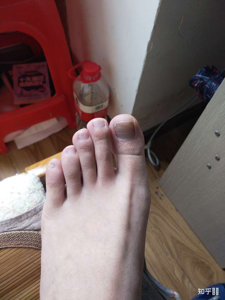 女生有一双很丑的脚有什么体验?