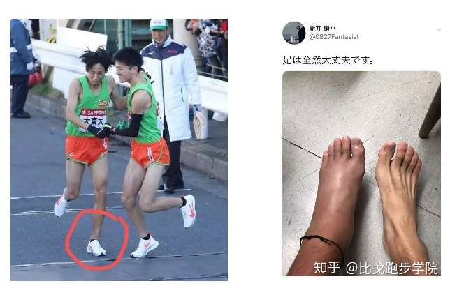 干货丨那个崴脚后坚持完成半马的男人太后悔了 知乎