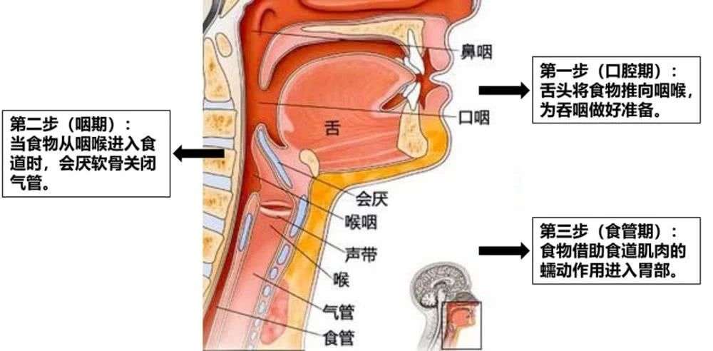 儿童吞咽障碍训练怎么做 这些方法推荐给不知道的你 知乎