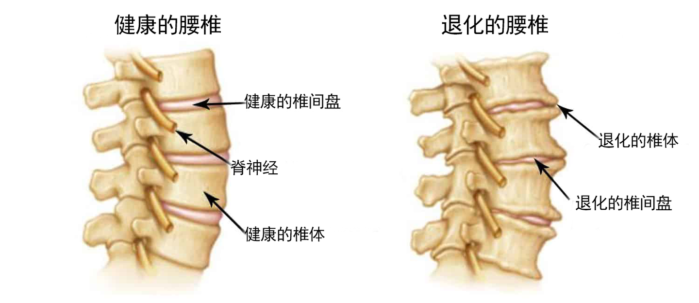 乔丹增高的秘密 牵引究竟有何意义 知乎