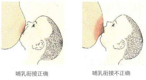 二胎备孕 别忽略了了解哺乳期乳腺炎 知乎