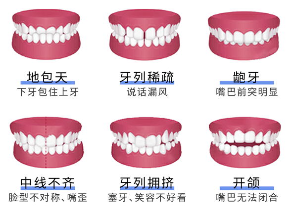 牙齿畸形有什么危害？