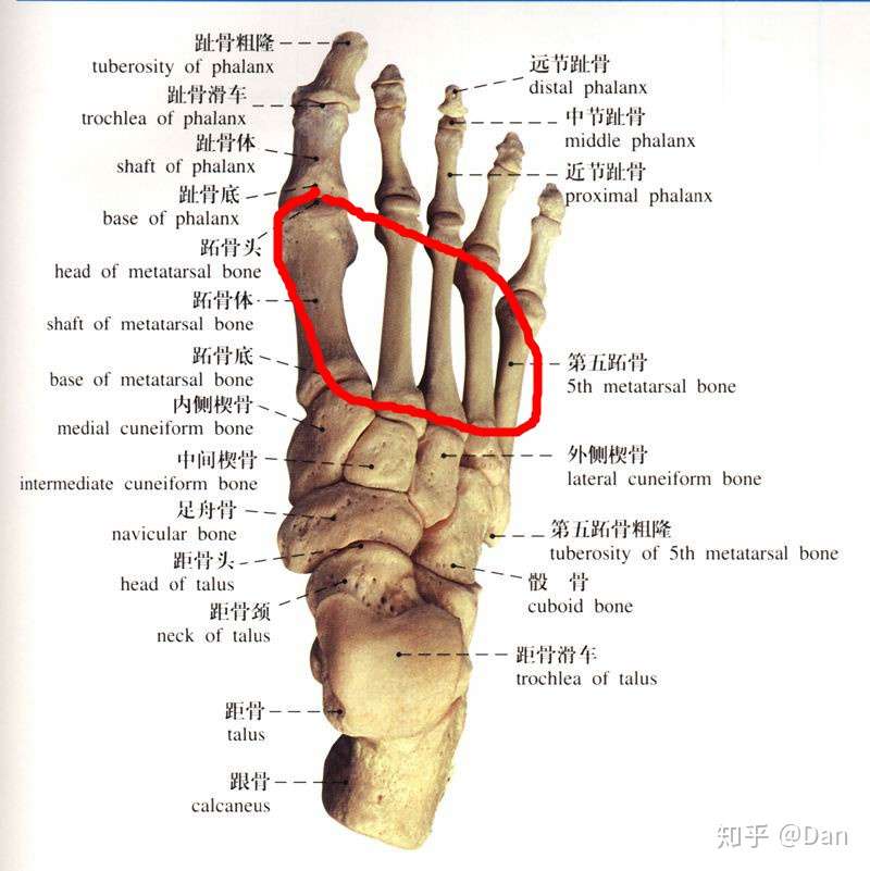 跖骨骨折日记 知乎