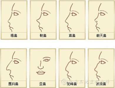 这是什么类型的鼻子,如果整的话该怎么整?