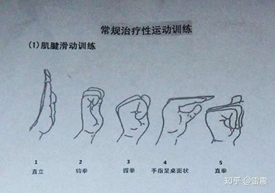 程序员怎么面对腱鞘炎