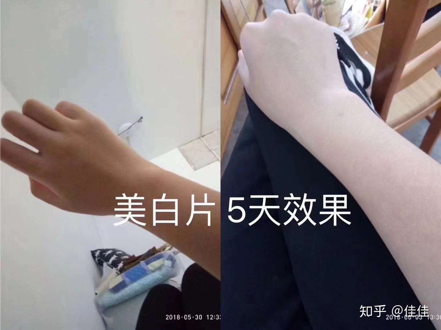 超强美白大法五天白 个度 天生黑也可以改变的 胶原蛋白可以美白吗 来看看我的经历吧 知乎