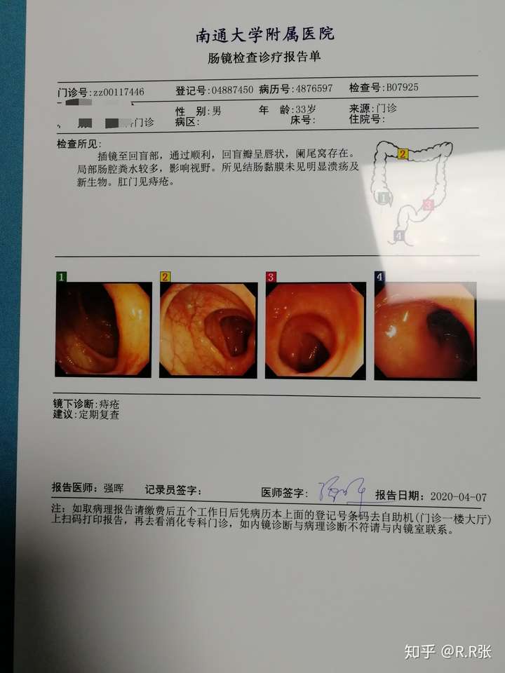 肠胃炎严重吗 知乎