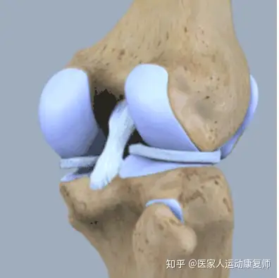 這些都是後交叉韌帶損傷常見表現以及人們常說的