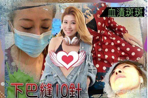 香港女歌手夜店被外国女子袭击 险毁容 网友 两个外国女人打架 知乎