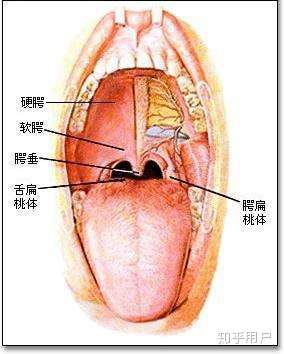 腭垂过长图片