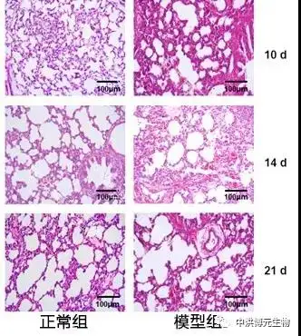 大鼠支氣管肺發育不良模型