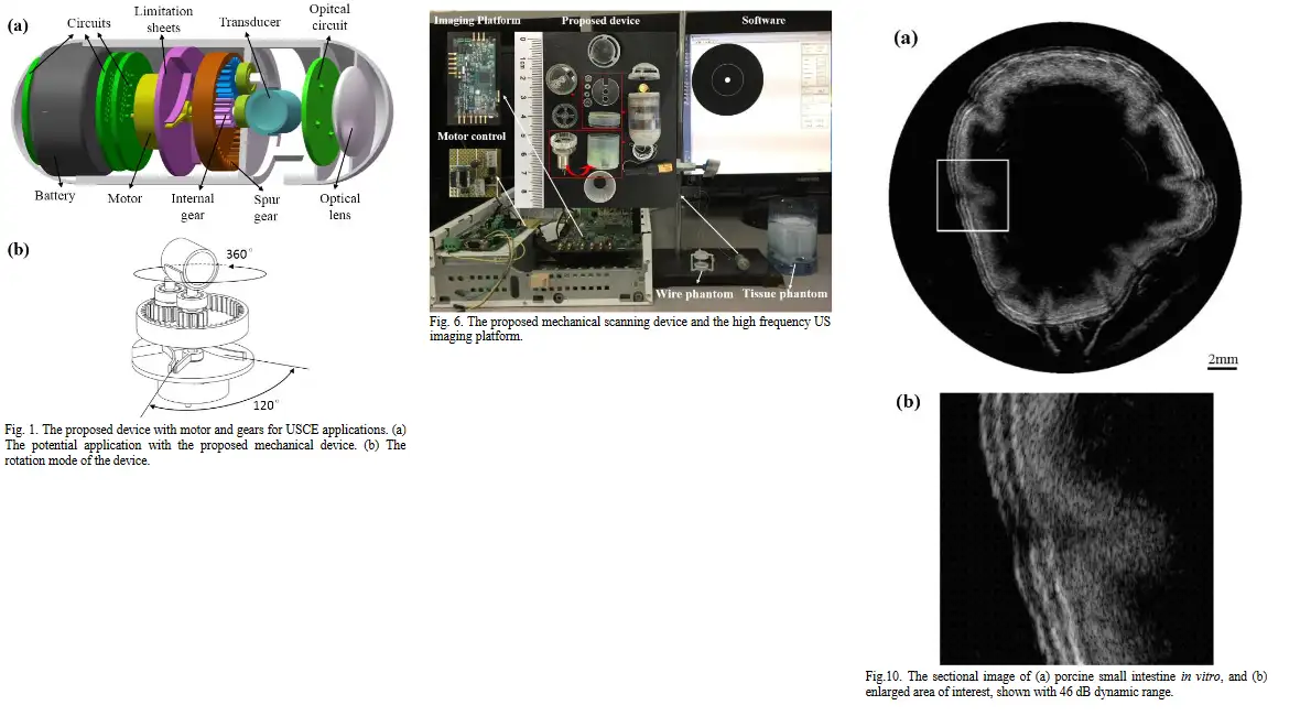 杂论文阅读】超声波胶囊内窥镜机械扫描装置（230104） - 知乎