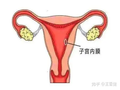 子宮內膜息肉手術後需要休息多久